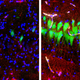 Active neurons (green) and cells (blue) in brains hooked up to the BrainEx system.